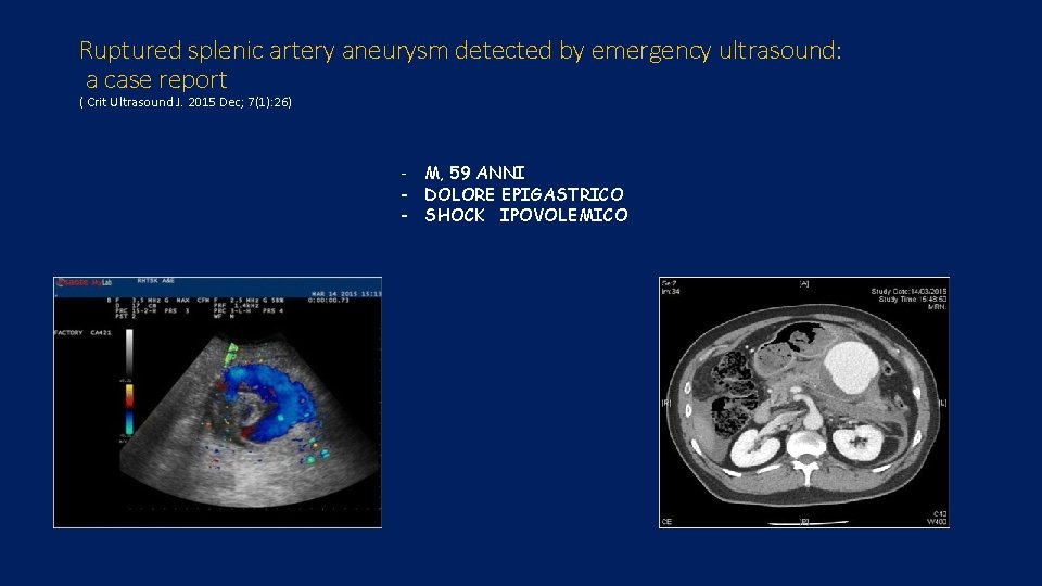 Ruptured splenic artery aneurysm detected by emergency ultrasound: a case report ( Crit Ultrasound