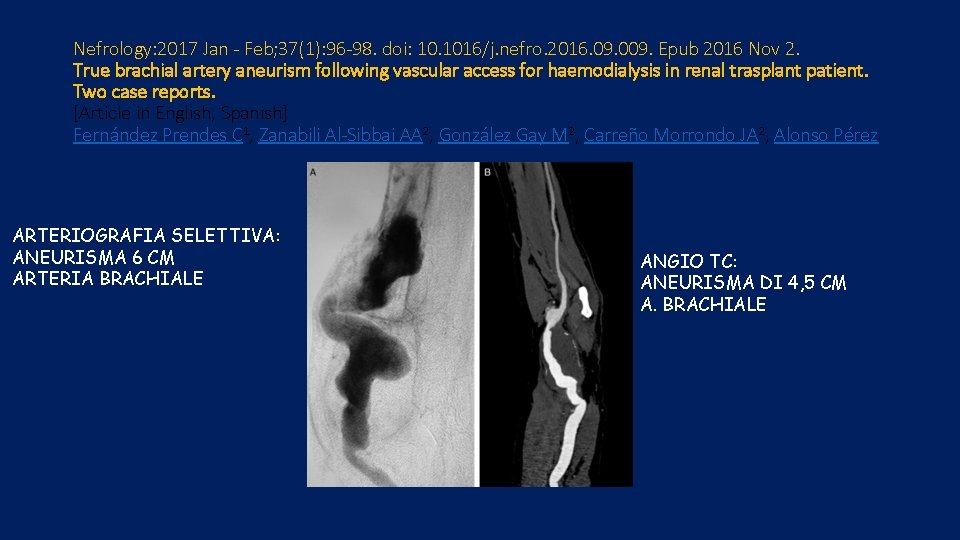 Nefrology: 2017 Jan - Feb; 37(1): 96 -98. doi: 10. 1016/j. nefro. 2016. 09.