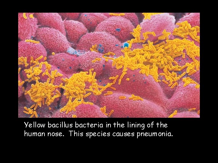 Yellow bacillus bacteria in the lining of the human nose. This species causes pneumonia.