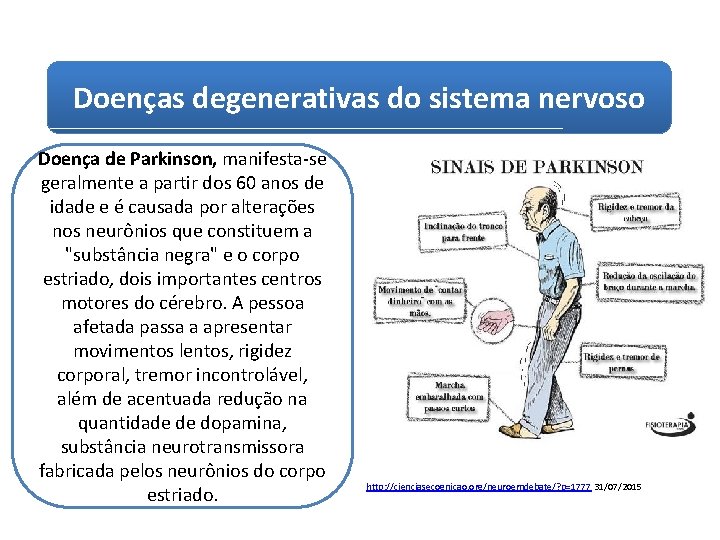 Doenças degenerativas do sistema nervoso Doença de Parkinson, manifesta-se geralmente a partir dos 60