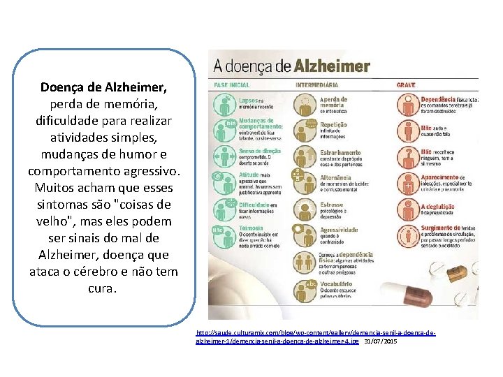 Doença de Alzheimer, perda de memória, dificuldade para realizar atividades simples, mudanças de humor
