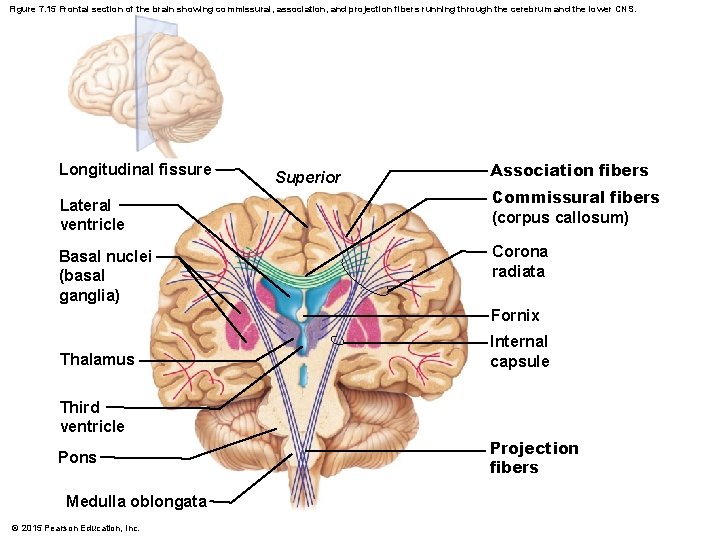 Figure 7. 15 Frontal section of the brain showing commissural, association, and projection fibers
