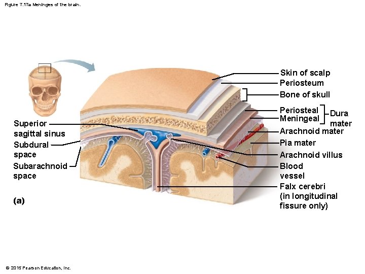 Figure 7. 17 a Meninges of the brain. Skin of scalp Periosteum Bone of