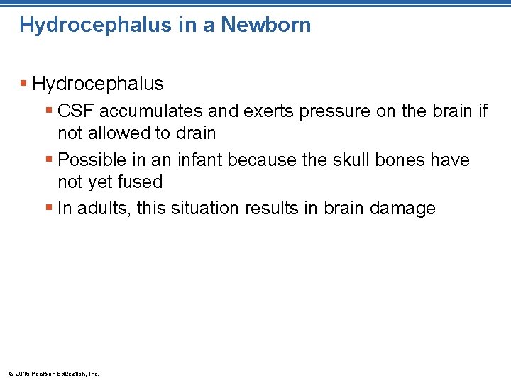 Hydrocephalus in a Newborn § Hydrocephalus § CSF accumulates and exerts pressure on the