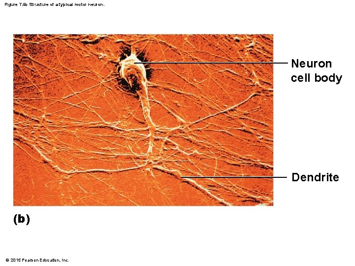 Figure 7. 4 b Structure of a typical motor neuron. Neuron cell body Dendrite