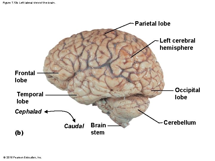 Figure 7. 13 b Left lateral view of the brain. Parietal lobe Left cerebral