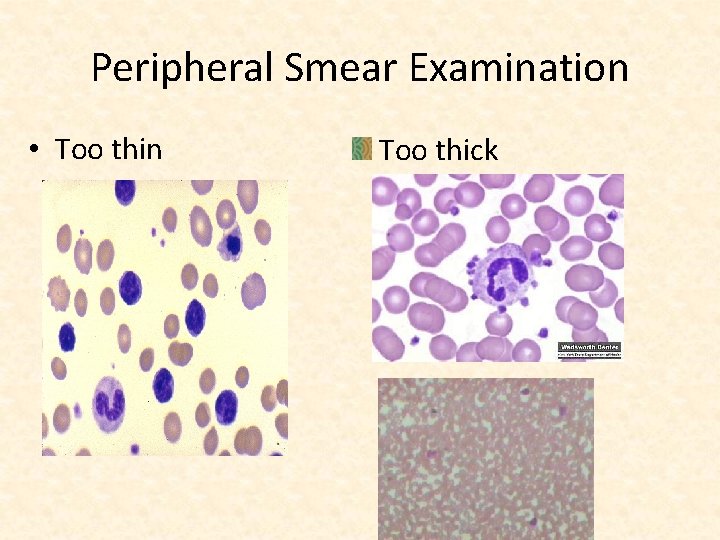 Peripheral Smear Examination • Too thin Too thick 