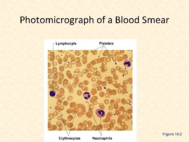 Photomicrograph of a Blood Smear Figure 10. 2 