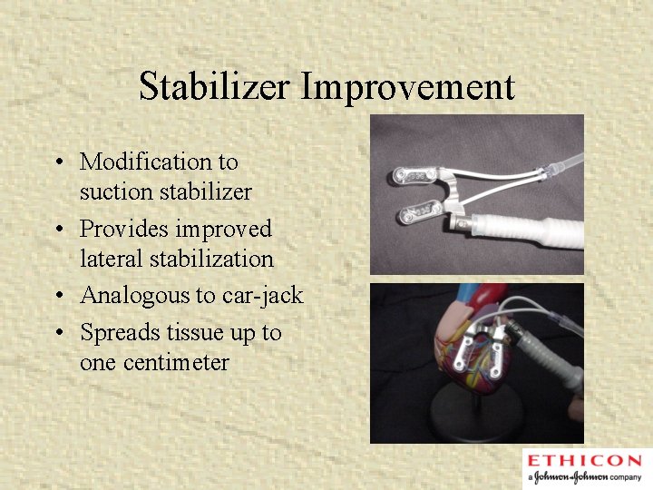Stabilizer Improvement • Modification to suction stabilizer • Provides improved lateral stabilization • Analogous