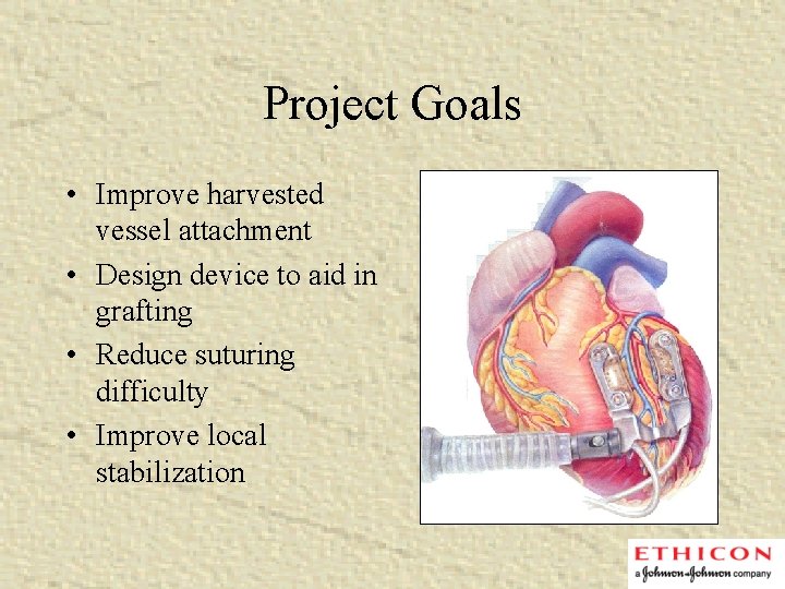 Project Goals • Improve harvested vessel attachment • Design device to aid in grafting