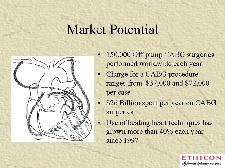 Market Potential • 150, 000 Off-pump CABG surgeries performed worldwide each year • Charge
