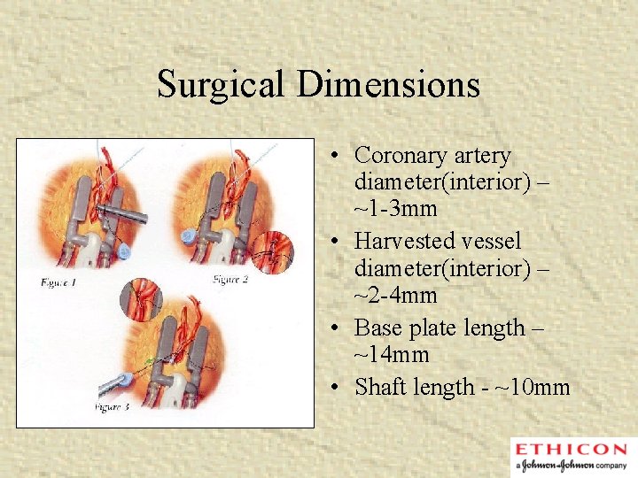 Surgical Dimensions • Coronary artery diameter(interior) – ~1 -3 mm • Harvested vessel diameter(interior)