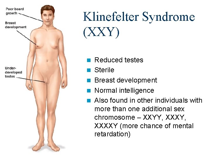 Klinefelter Syndrome (XXY) n n n Reduced testes Sterile Breast development Normal intelligence Also