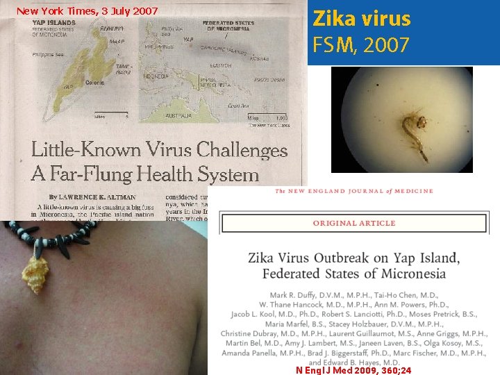 New York Times, 3 July 2007 5 5 Zika virus FSM, 2007 N Engl