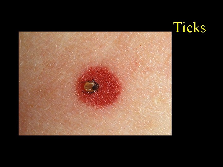 Ticks 