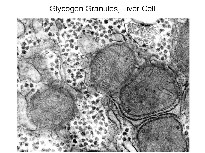 Glycogen Granules, Liver Cell 