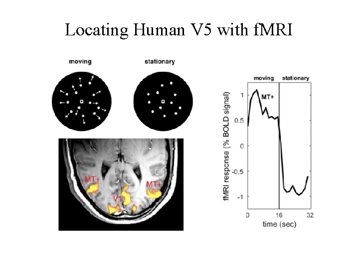 Locating Human V 5 with f. MRI 