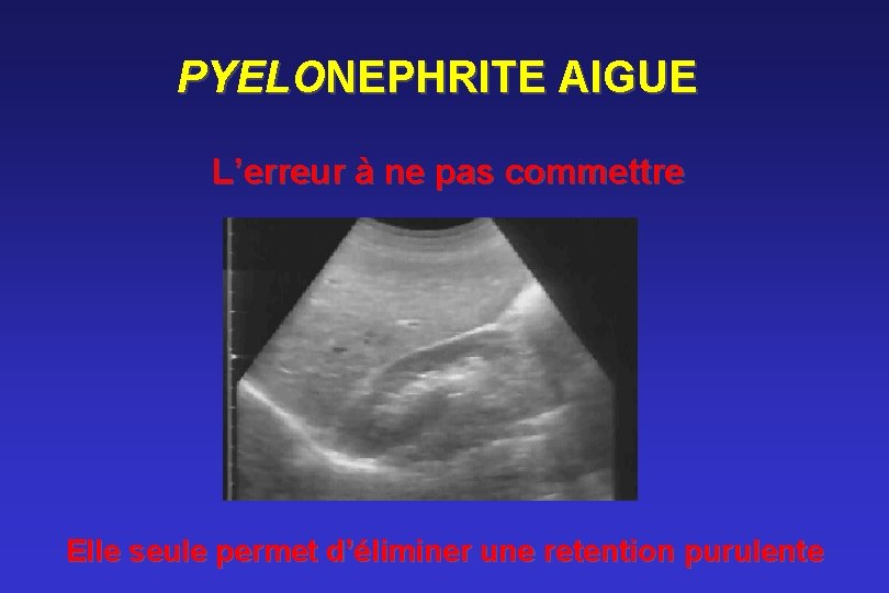 PYELONEPHRITE AIGUE L’erreur à ne pas commettre Elle seule permet d’éliminer une retention purulente