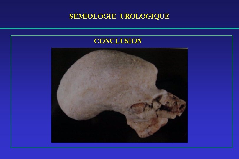 SEMIOLOGIE UROLOGIQUE CONCLUSION 