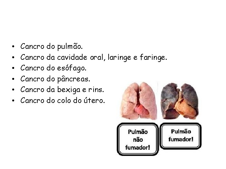  • • • Cancro do pulmão. Cancro da cavidade oral, laringe e faringe.