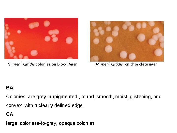 N. meningitidis colonies on Blood Agar N. meningitidis on chocolate agar BA Colonies are