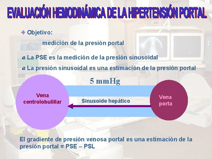 Objetivo: medición de la presión portal La PSE es la medición de la presión