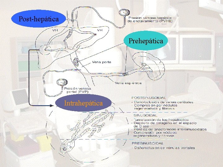 Post-hepática Prehepática Intrahepática 