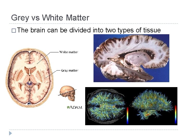 Grey vs White Matter � The brain can be divided into two types of Grey vs White Matter � The brain can be divided into two types of