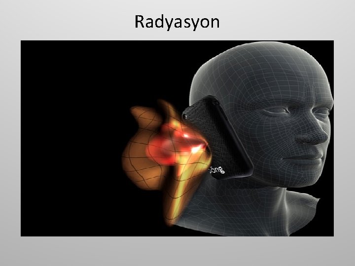 Radyasyon 