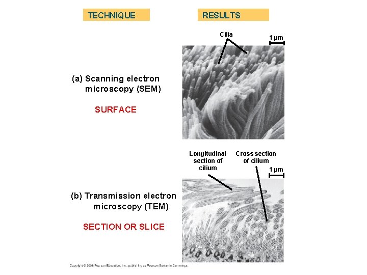TECHNIQUE RESULTS Cilia 1 µm (a) Scanning electron microscopy (SEM) SURFACE Longitudinal section of