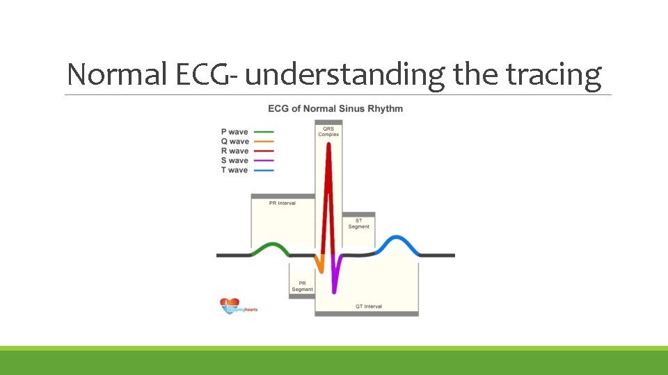 Normal ECG- understanding the tracing 