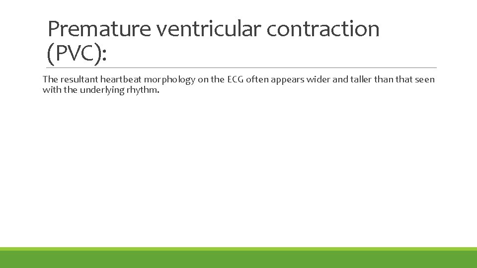 Premature ventricular contraction (PVC): The resultant heartbeat morphology on the ECG often appears wider