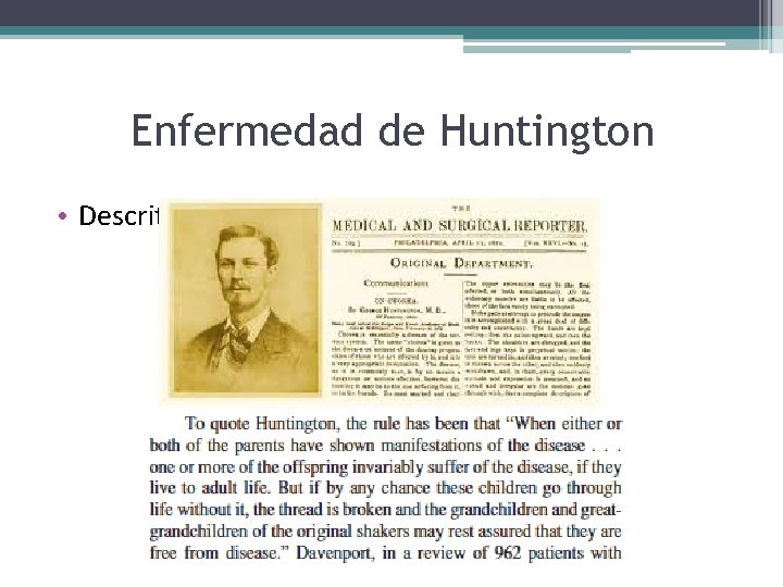Enfermedad de Huntington • Descrita por George Huntington, 1872 