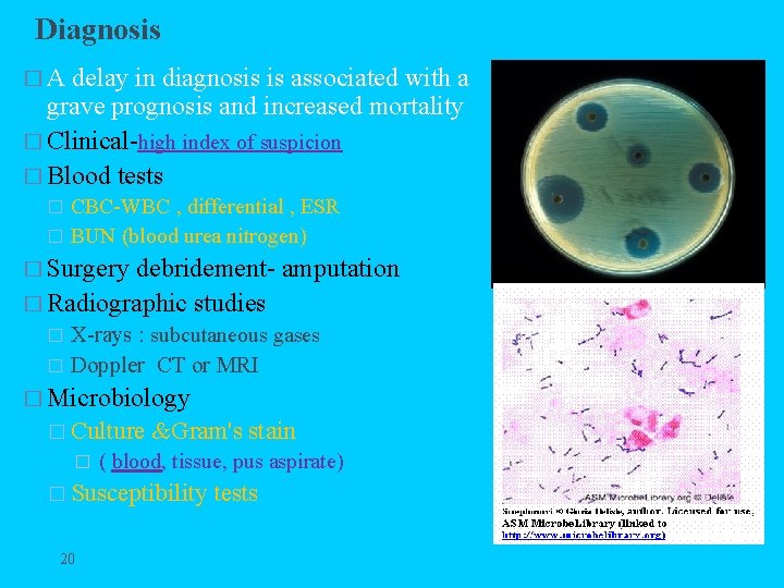 Diagnosis �A delay in diagnosis is associated with a grave prognosis and increased mortality