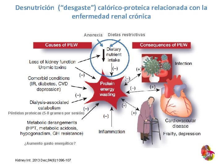 Desnutrición (“desgaste”) calórico-proteica relacionada con la enfermedad renal crónica Anorexia Pérdidas proteicas (5 -8