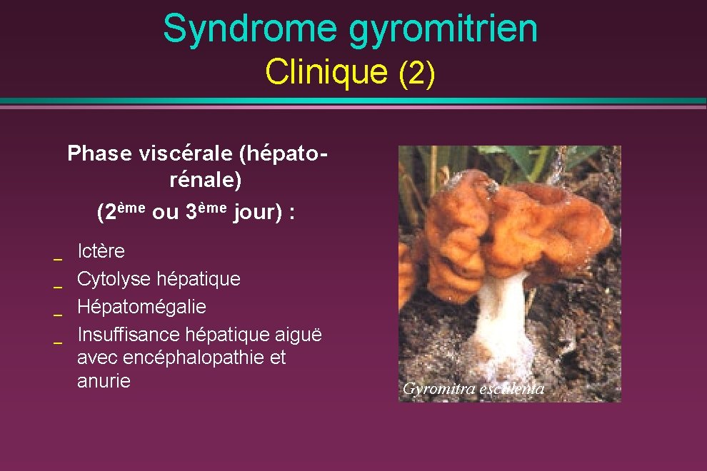 Syndrome gyromitrien Clinique (2) Phase viscérale (hépatorénale) (2ème ou 3ème jour) : _ _