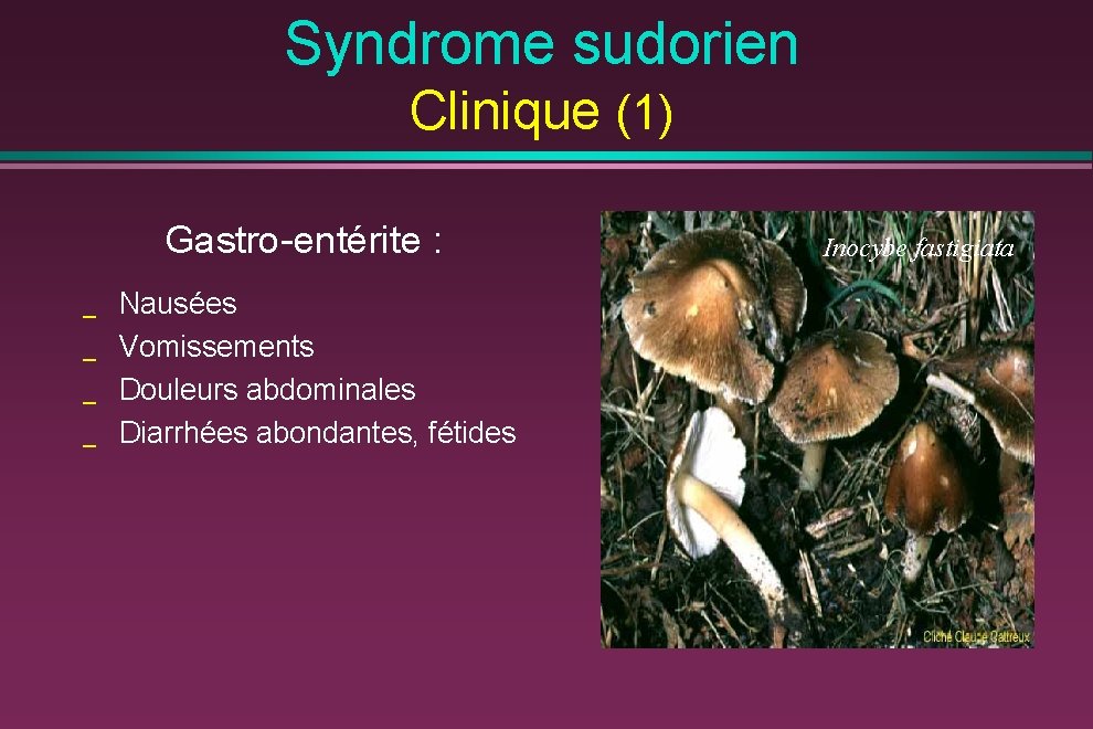 Syndrome sudorien Clinique (1) Gastro-entérite : _ _ Nausées Vomissements Douleurs abdominales Diarrhées abondantes,