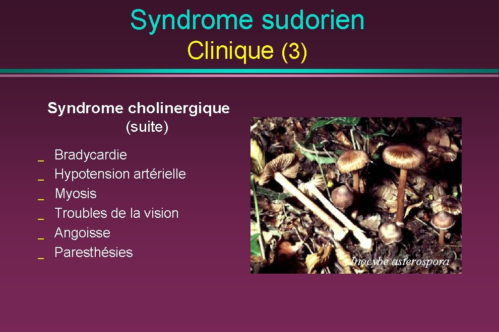 Syndrome sudorien Clinique (3) Syndrome cholinergique (suite) _ _ _ Bradycardie Hypotension artérielle Myosis