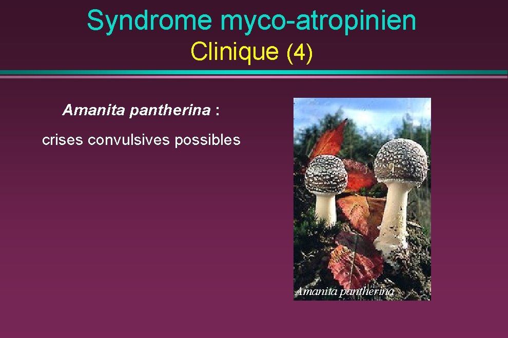 Syndrome myco-atropinien Clinique (4) Amanita pantherina : crises convulsives possibles Amanita pantherina 