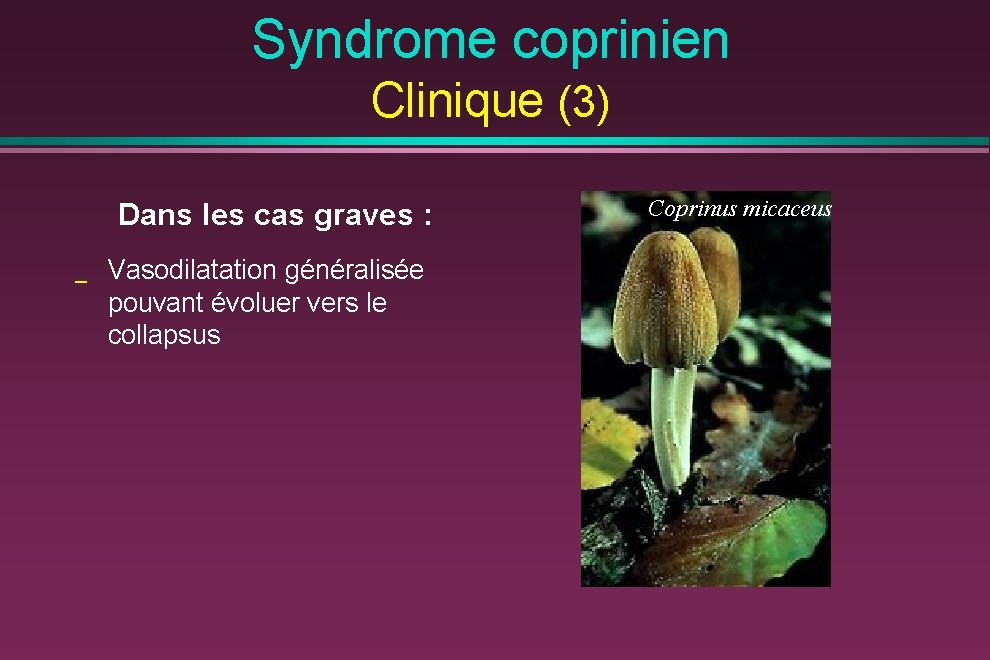 Syndrome coprinien Clinique (3) Dans les cas graves : _ Vasodilatation généralisée pouvant évoluer