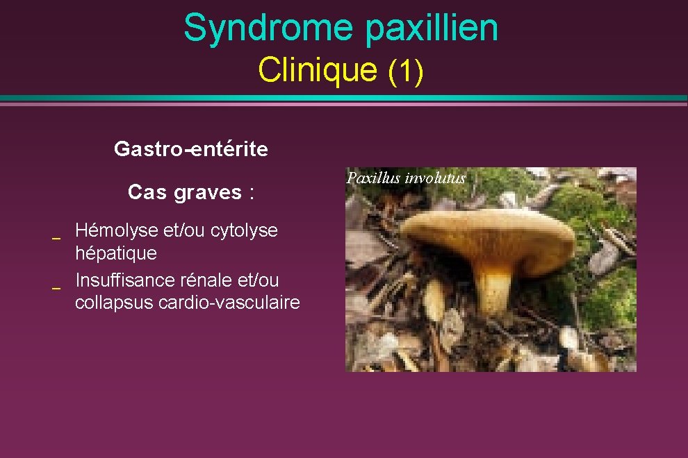 Syndrome paxillien Clinique (1) Gastro-entérite Cas graves : _ _ Hémolyse et/ou cytolyse hépatique