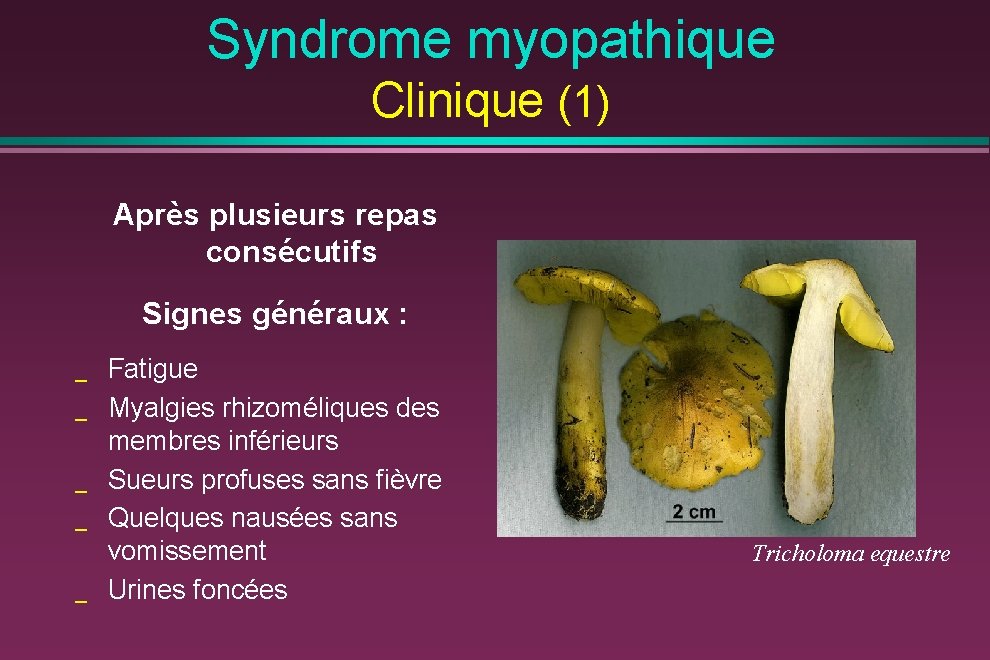 Syndrome myopathique Clinique (1) Après plusieurs repas consécutifs Signes généraux : _ _ _