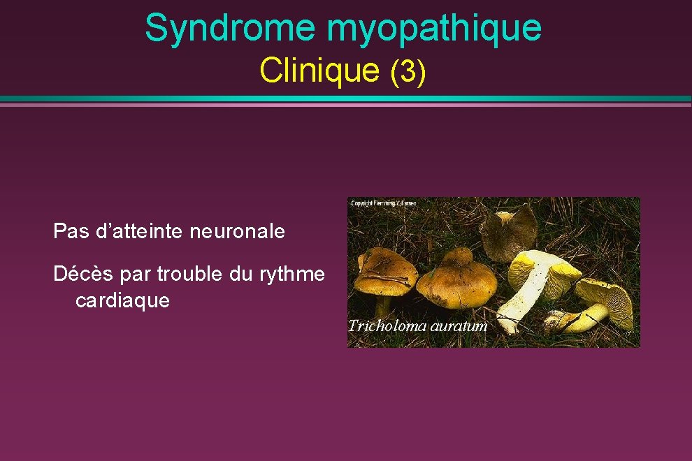 Syndrome myopathique Clinique (3) Pas d’atteinte neuronale Décès par trouble du rythme cardiaque Tricholoma