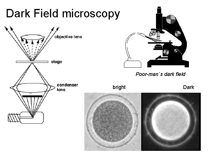 Dark Field microscopy Poor-man`s dark field bright Dark 
