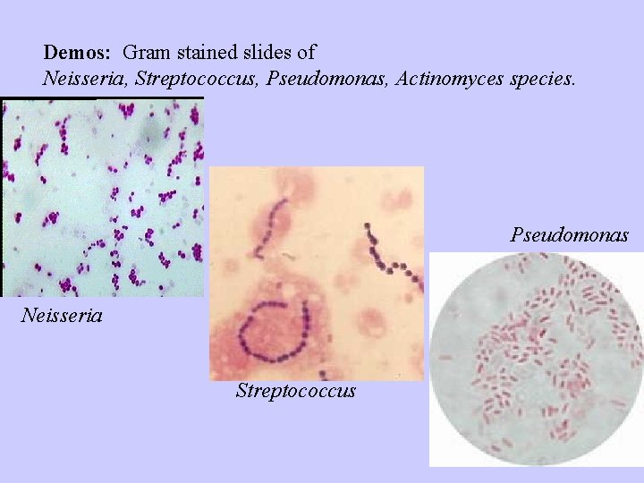 Demos: Gram stained slides of Neisseria, Streptococcus, Pseudomonas, Actinomyces species. Pseudomonas Neisseria Streptococcus 