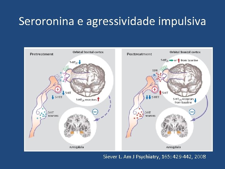 Seroronina e agressividade impulsiva Siever L. Am J Psychiatry, 165: 429 -442, 2008 