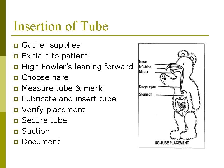 Insertion of Tube p p p p p Gather supplies Explain to patient High