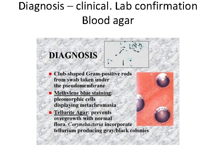 Diagnosis – clinical. Lab confirmation Blood agar 