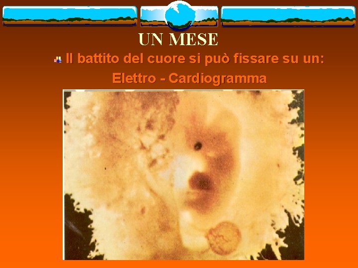 UN MESE Il battito del cuore si può fissare su un: Elettro - Cardiogramma