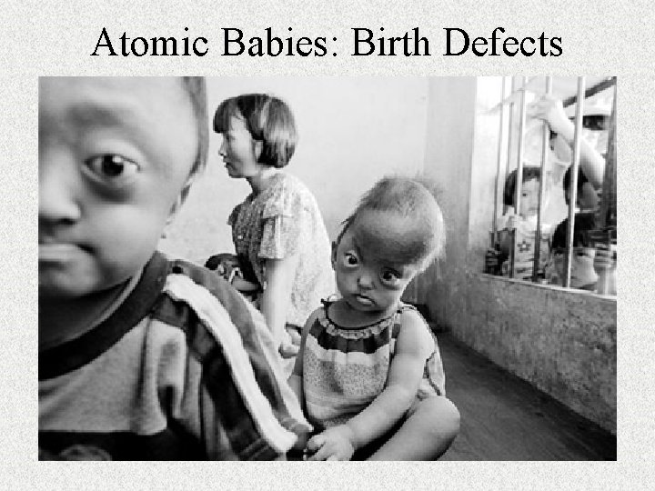 Atomic Babies: Birth Defects 